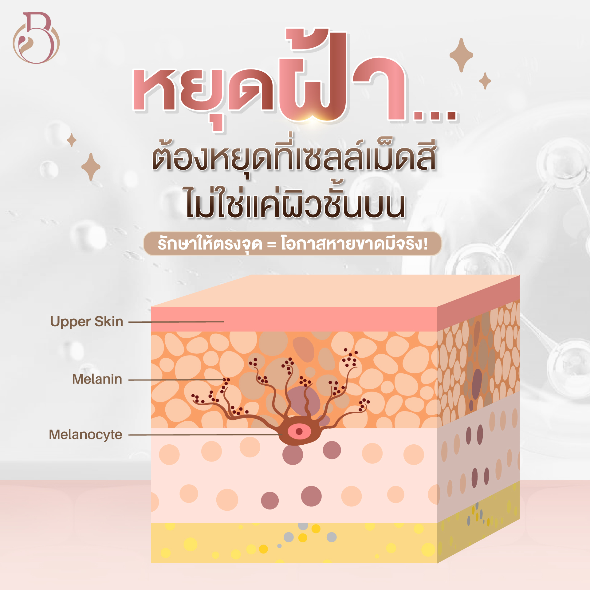 ฝ้า กระ จุดด่างดำ ลดฝ้า จำกัดฝ้า